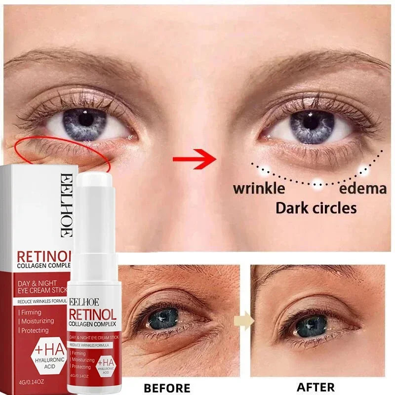 Retinol Wrinkle Remover Face Set Instant Firming Lifting Anti-Aging Serum Fade Fine Lines Whitening Korean Skin Care Product New