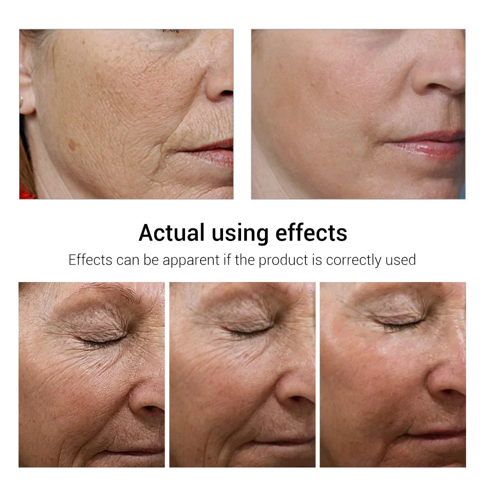 Retinol Wrinkle Remover Face Set Instant Firming Lifting Anti-Aging Serum Fade Fine Lines Whitening Korean Skin Care Product New