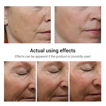 Retinol Wrinkle Remover Face Set Instant Firming Lifting Anti-Aging Serum Fade Fine Lines Whitening Korean Skin Care Product New