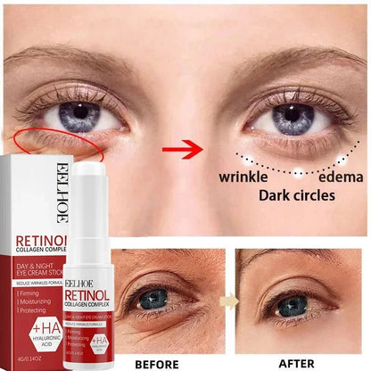 Retinol Wrinkle Remover Face Set Instant Firming Lifting Anti-Aging Serum Fade Fine Lines Whitening Korean Skin Care Product New